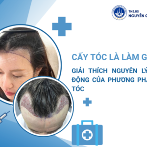 cấy tóc là làm gì