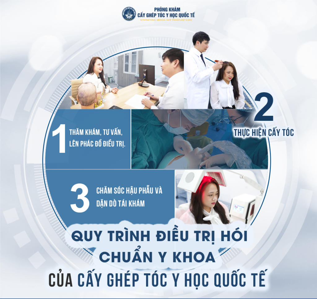 Vai trò ThS. BS Nguyễn Quốc Tuấn trong cấy tóc