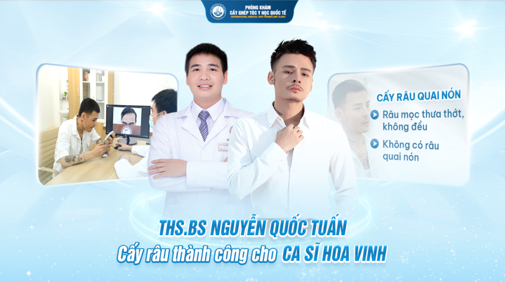 THS.BS Nguyễn Quốc Tuấn cấy râu thành công cho Ca sĩ Hoa Vinh