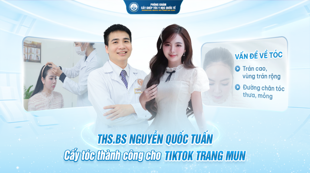 THS.BS Nguyễn Quốc Tuấn cấy tóc thành công cho Hot Tiktok Trang Mun