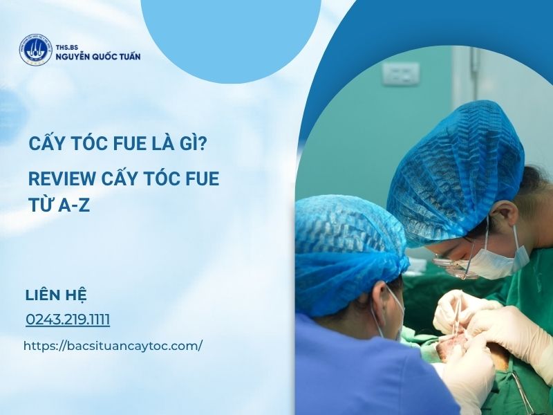 cấy tóc fue là gì