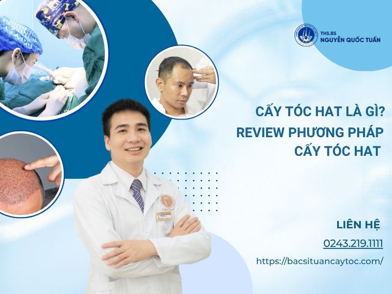 cấy tóc HAT là gì