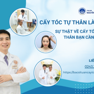 cấy tóc tự thân là gì