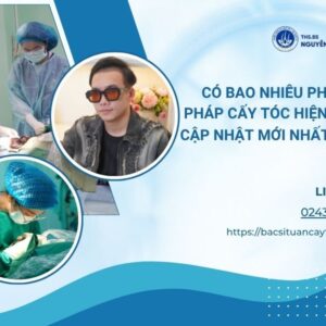 phương pháp cấy tóc hiện nay