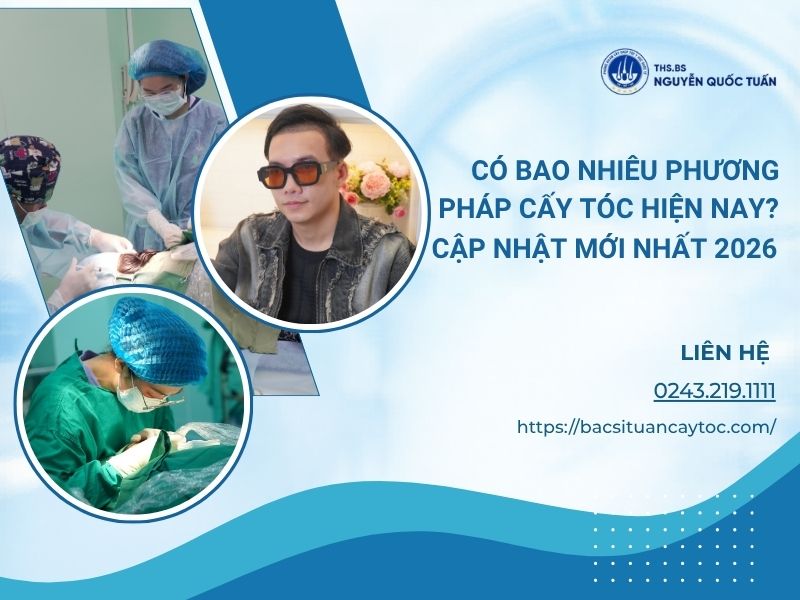 phương pháp cấy tóc hiện nay