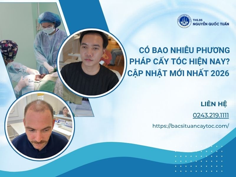 phương pháp cấy tóc