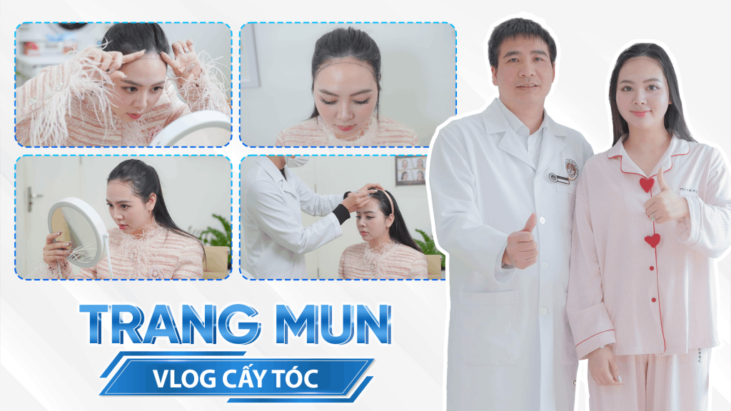 ThS.BS Nguyễn Quốc Tuấn cấy tóc cho Hot Tiktok Trang Mun