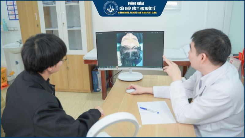 Bác sĩ giải đáp thắc mắc cấy tóc có vĩnh viễn không