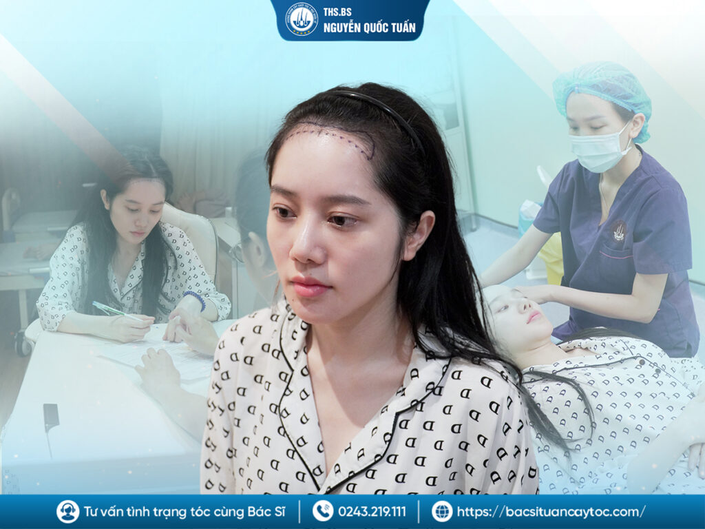  Ai nên và không nên cấy tóc tự thân? 