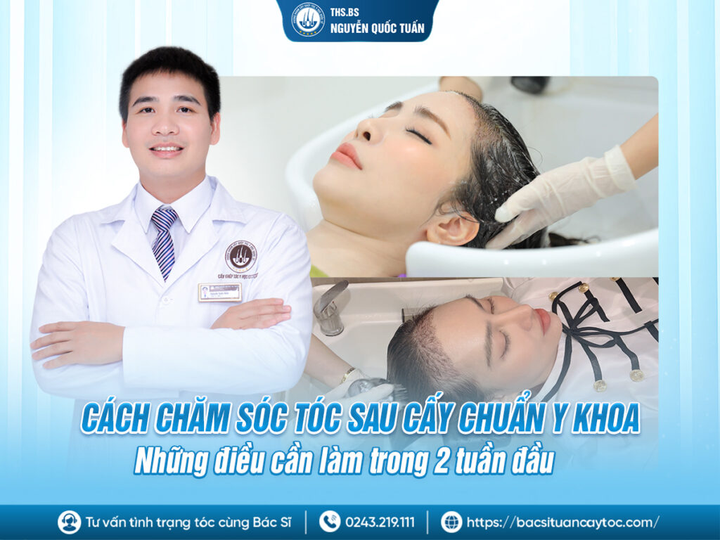 cách chăm sóc tóc sau cấy
