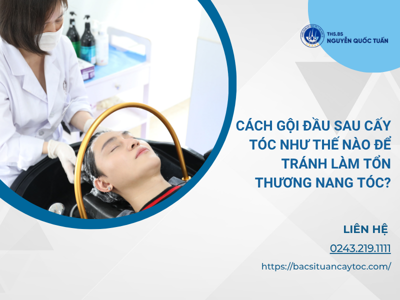 cách gội đầu sau cấy tóc