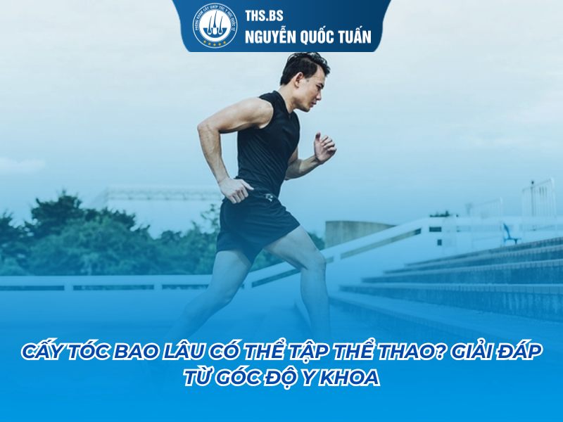 cấy tóc bao lâu có thể tập thể dục