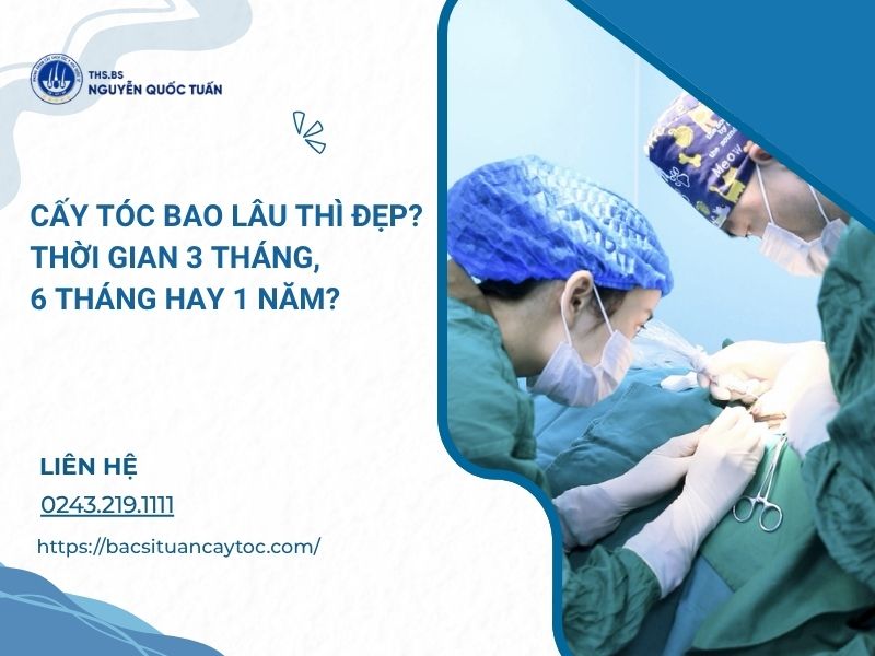 cấy tóc bao lâu thì đẹp