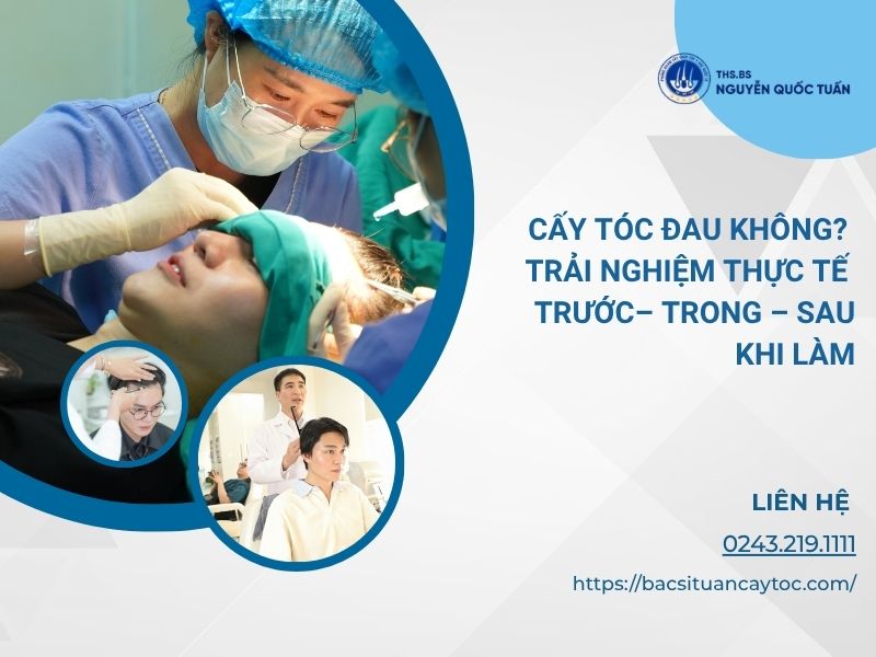 cấy tóc có đau không