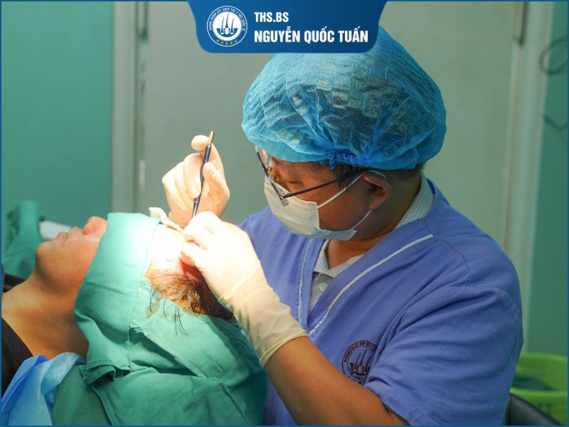 Cấy tóc hói có đau không và có để lại sẹo không?