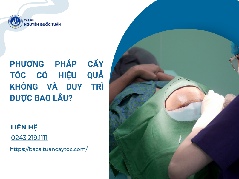 cấy tóc có hiệu quả không