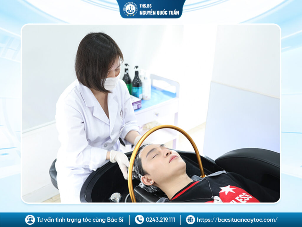 Có phát sinh chi phí sau khi cấy tóc không? Những khoản nhiều người không biết 