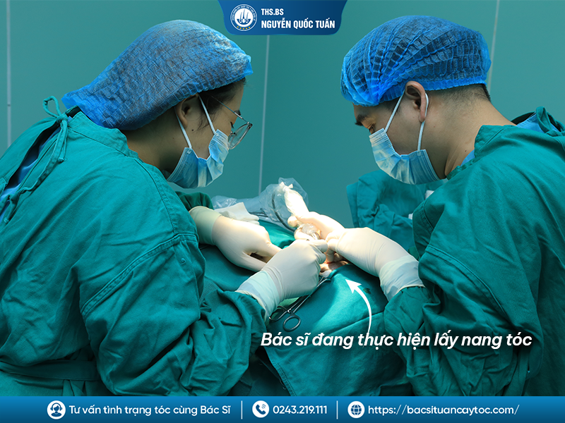 Vì sao cấy tóc có thể hình thành sẹo?