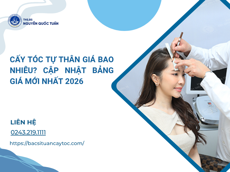 cấy tóc giá bao nhiêu