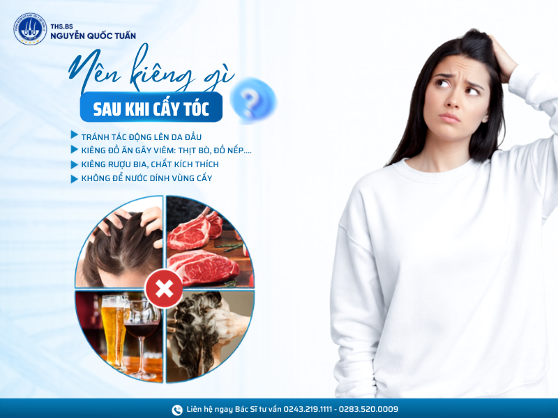 cấy tóc nên kiêng gì