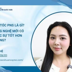 cấy tóc pns