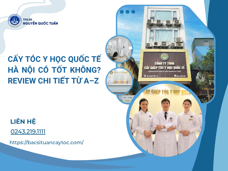 cấy tóc y học quốc tế hà nội có tốt không