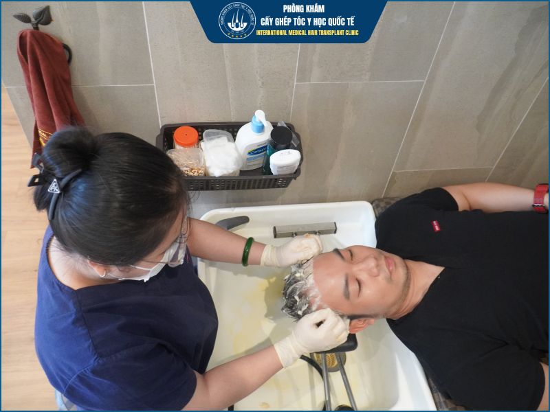 5 yếu tố quyết định cấy tóc có hiệu quả hay không? 