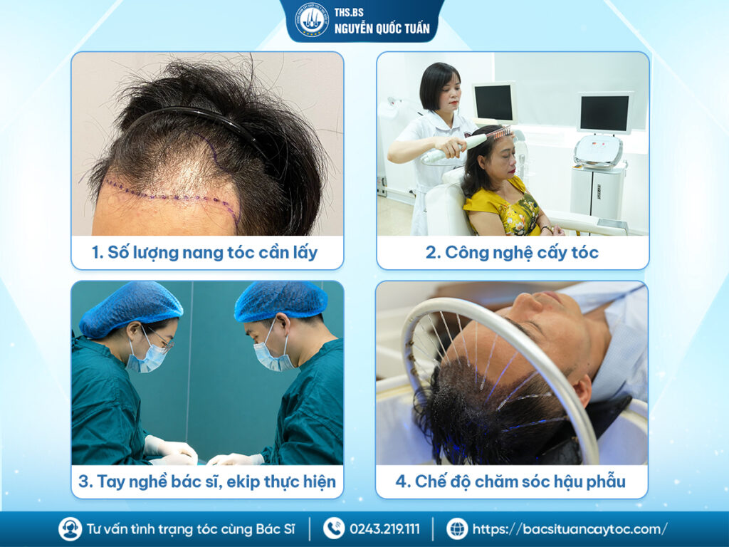 Chi phí cấy đường chân tóc phụ thuộc vào những yếu tố nào? 
