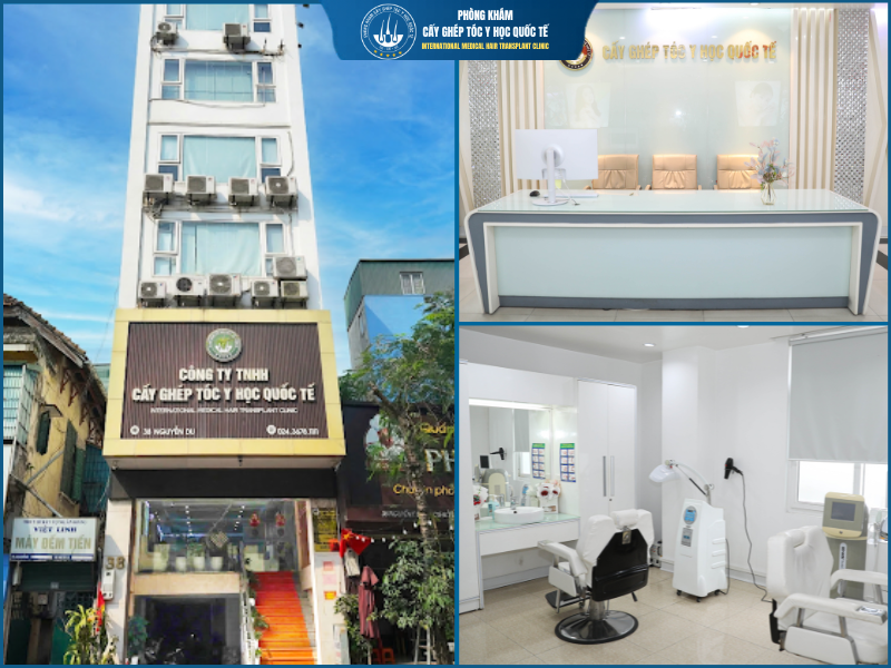 Giới thiệu về Viện cấy tóc Y học Quốc tế Hà Nội