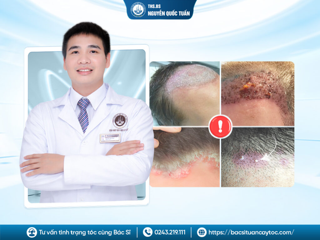 Giá rẻ có nên làm không? Cảnh báo những rủi ro khi chọn sai nơi 