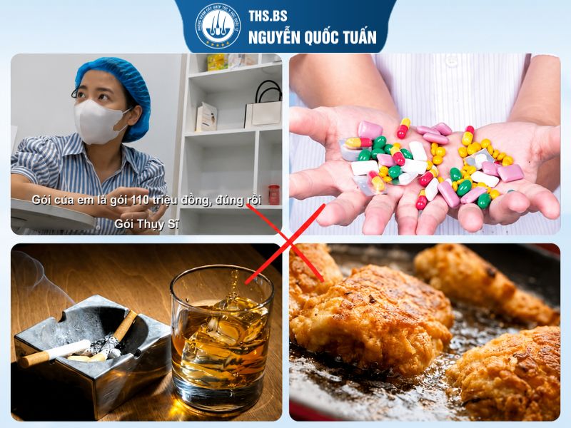 Những sai lầm làm giảm tỉ lệ mọc tóc sau cấy