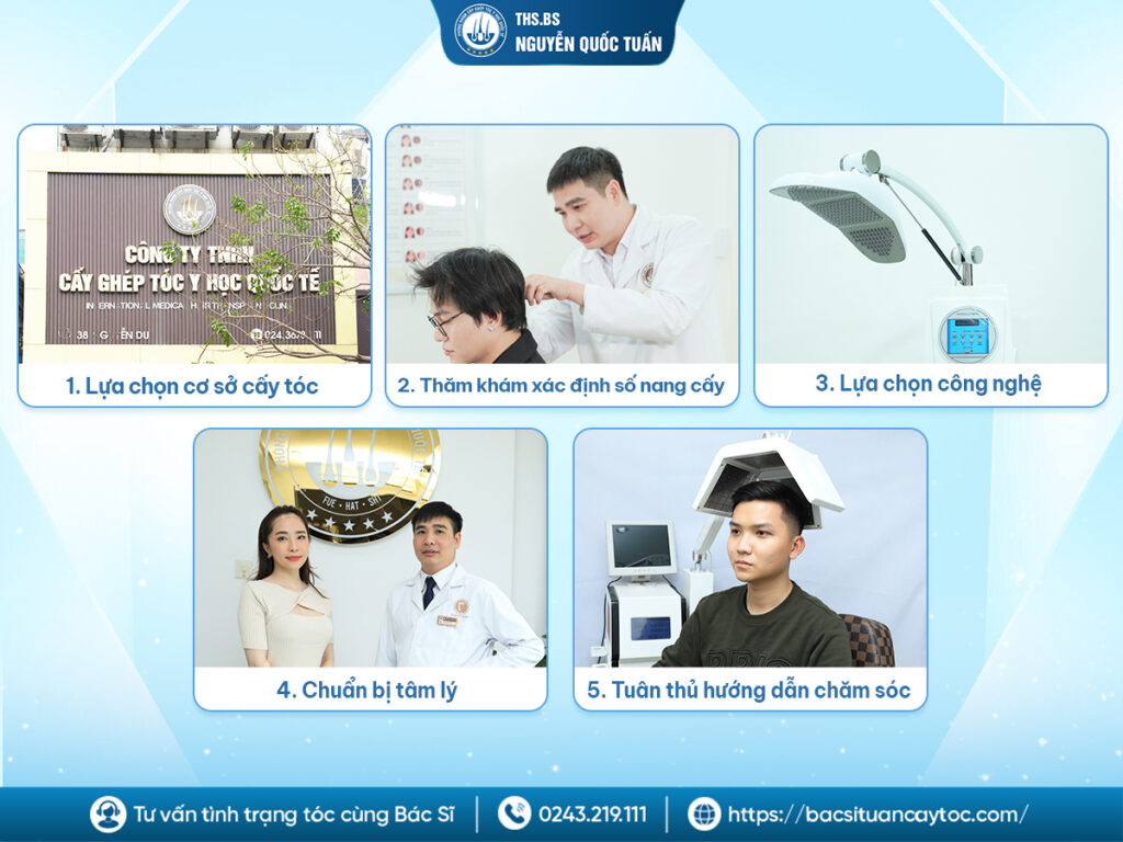 Lưu ý cần biết trước khi quyết định thực hiện dịch vụ 
