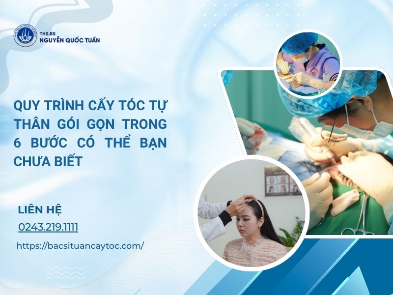 quy trình cấy tóc tự thân