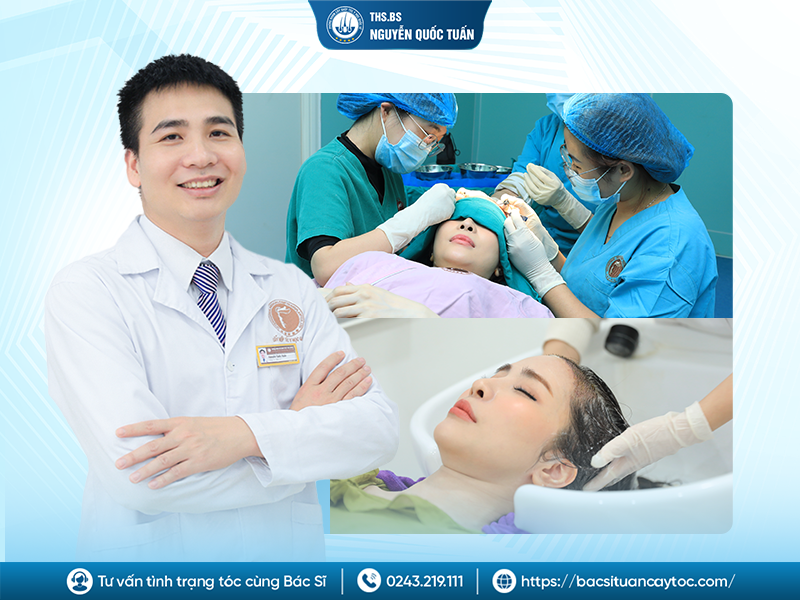 Trường hợp nào cấy tóc dễ để lại sẹo xấu?
