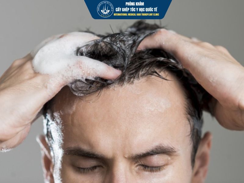 7 sai lầm khi gội đầu có thể làm giảm hiệu quả cấy ghép 
