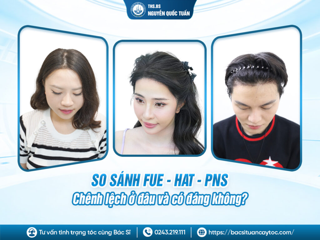 Sự khác biệt giữa các phương pháp cấy tóc tự thân 
