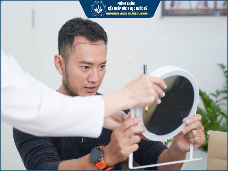 Đừng chọn theo xu hướng: Ai phù hợp với HAT, ai nên lựa chọn DHI?