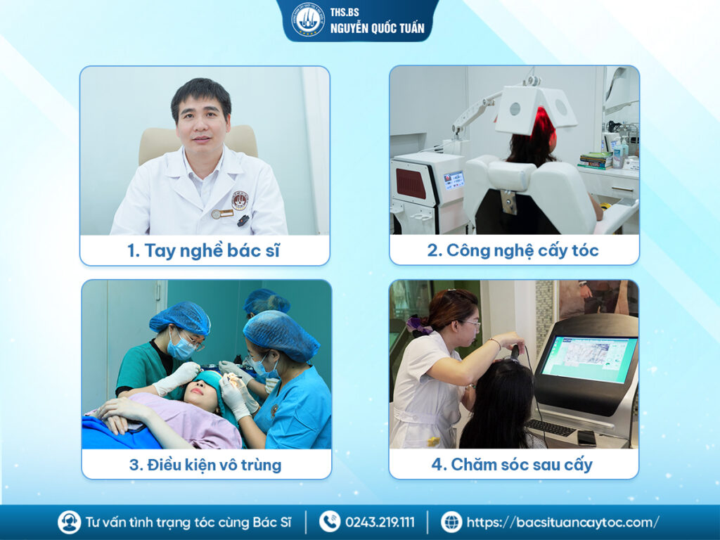 Những yếu tố quyết định mức độ an toàn khi cấy tóc 