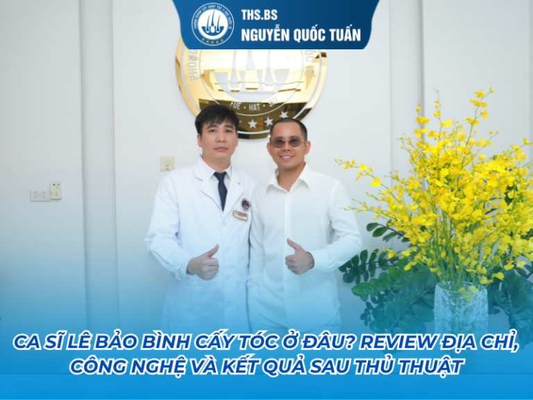 ca sĩ lê bảo bình cấy tóc ở đâu