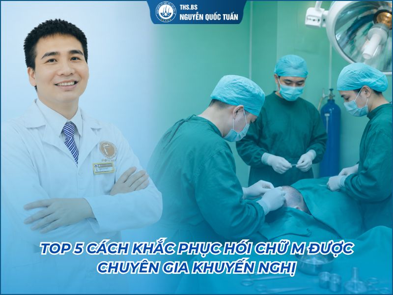 cách khắc phục hói chữ M