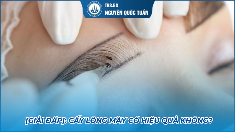 cấy lông mày có hiệu quả không