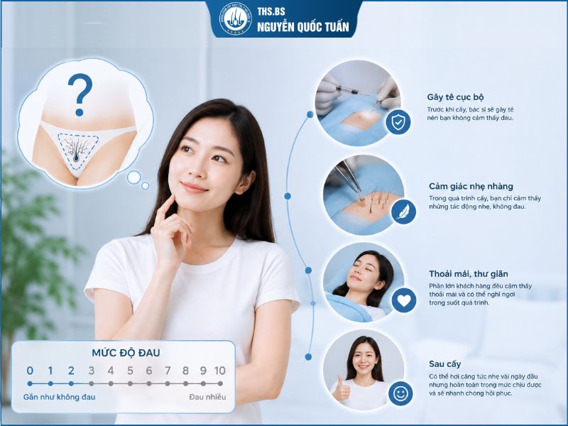 Cấy lông mu có đau không?