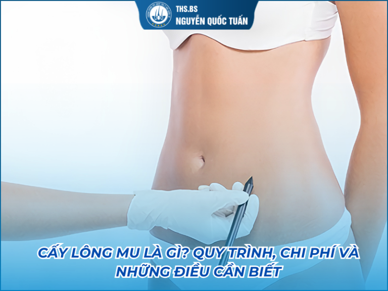 cấy lông mu là gì