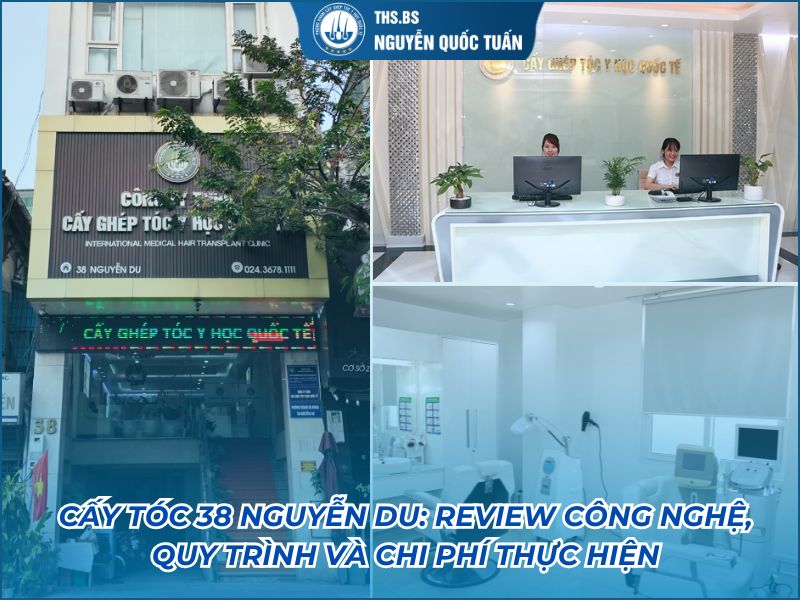 Cấy tóc 38 Nguyễn Du: Review công nghệ, quy trình và chi phí thực hiện