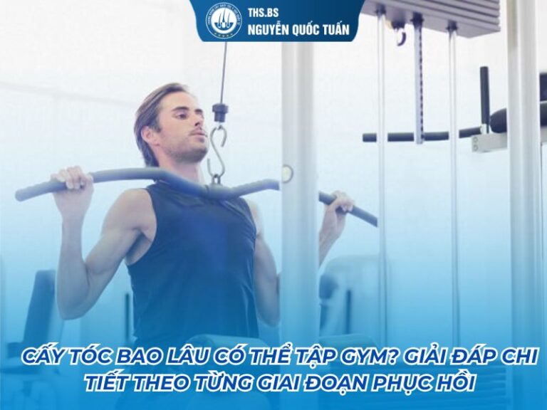 cấy tóc bao lâu có thể tập gym