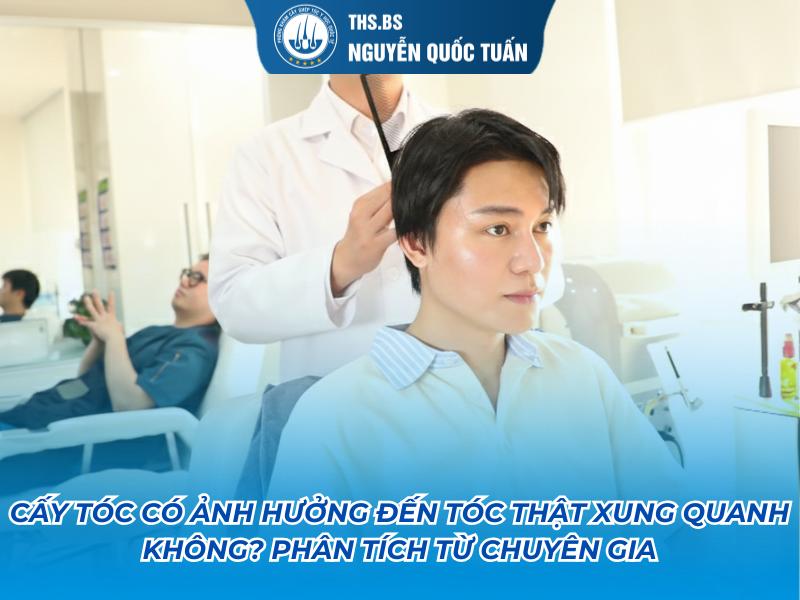 cấy tóc có ảnh hưởng đến tóc thật xung quanh không