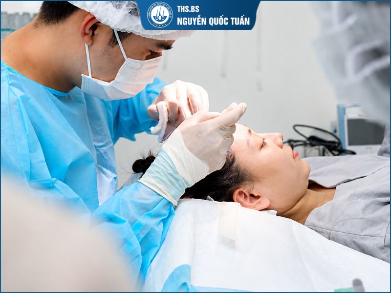  Cấy tóc giá rẻ: Vì sao ngày càng nhiều người lựa chọn? 