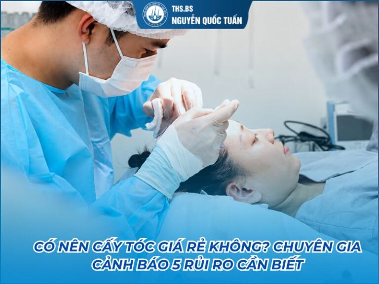 cấy tóc giá rẻ