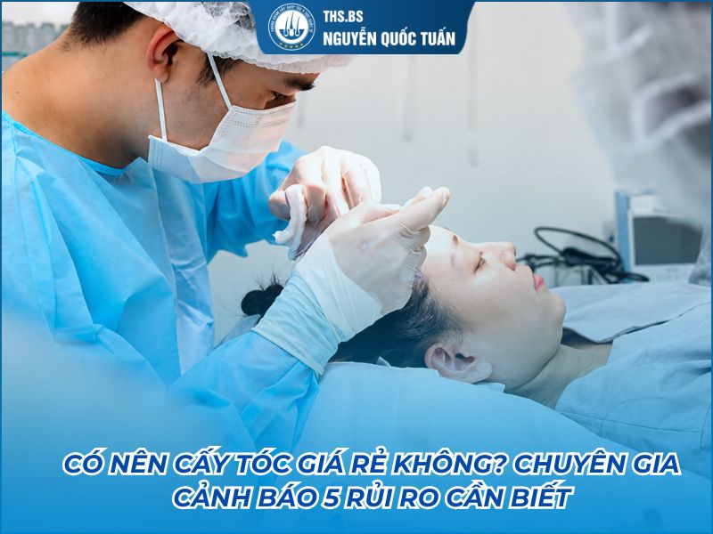 cấy tóc giá rẻ