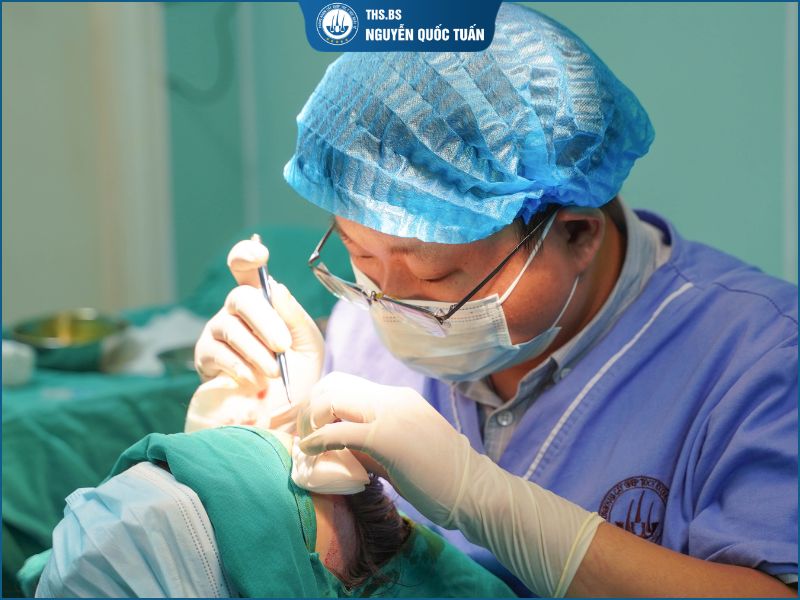 Cấy tóc tự thân 